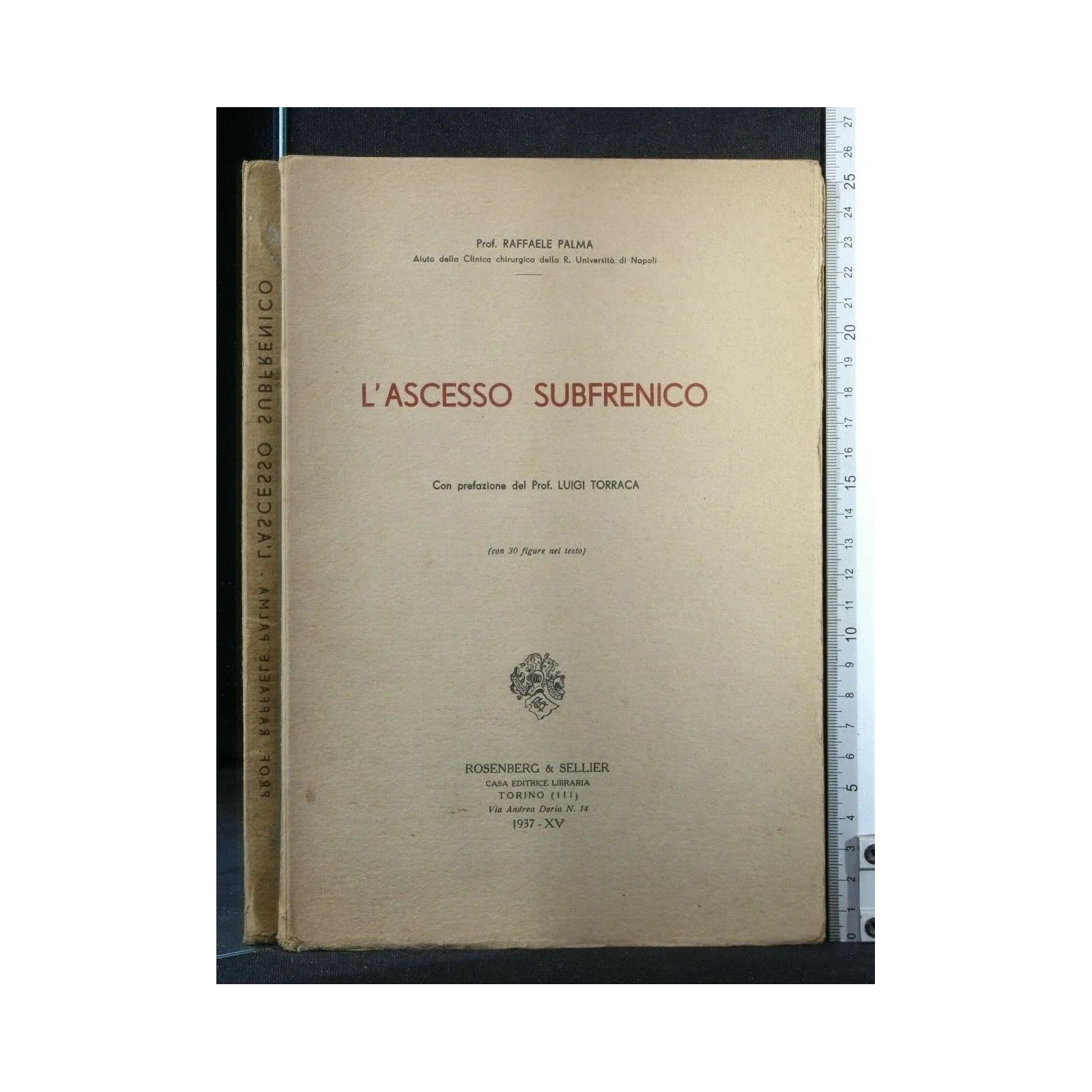 L'ASCESSO SUBFRENICO