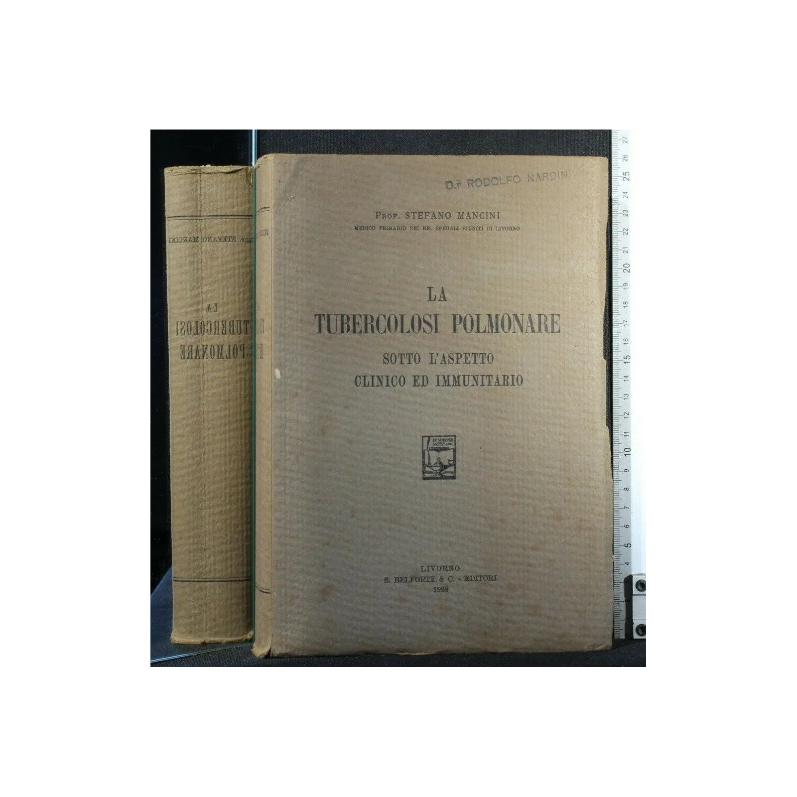 LA TUBERCOLOSI POLMONARE SOTTO L'ASPETTO CLINICO ED IMMUNITARIO