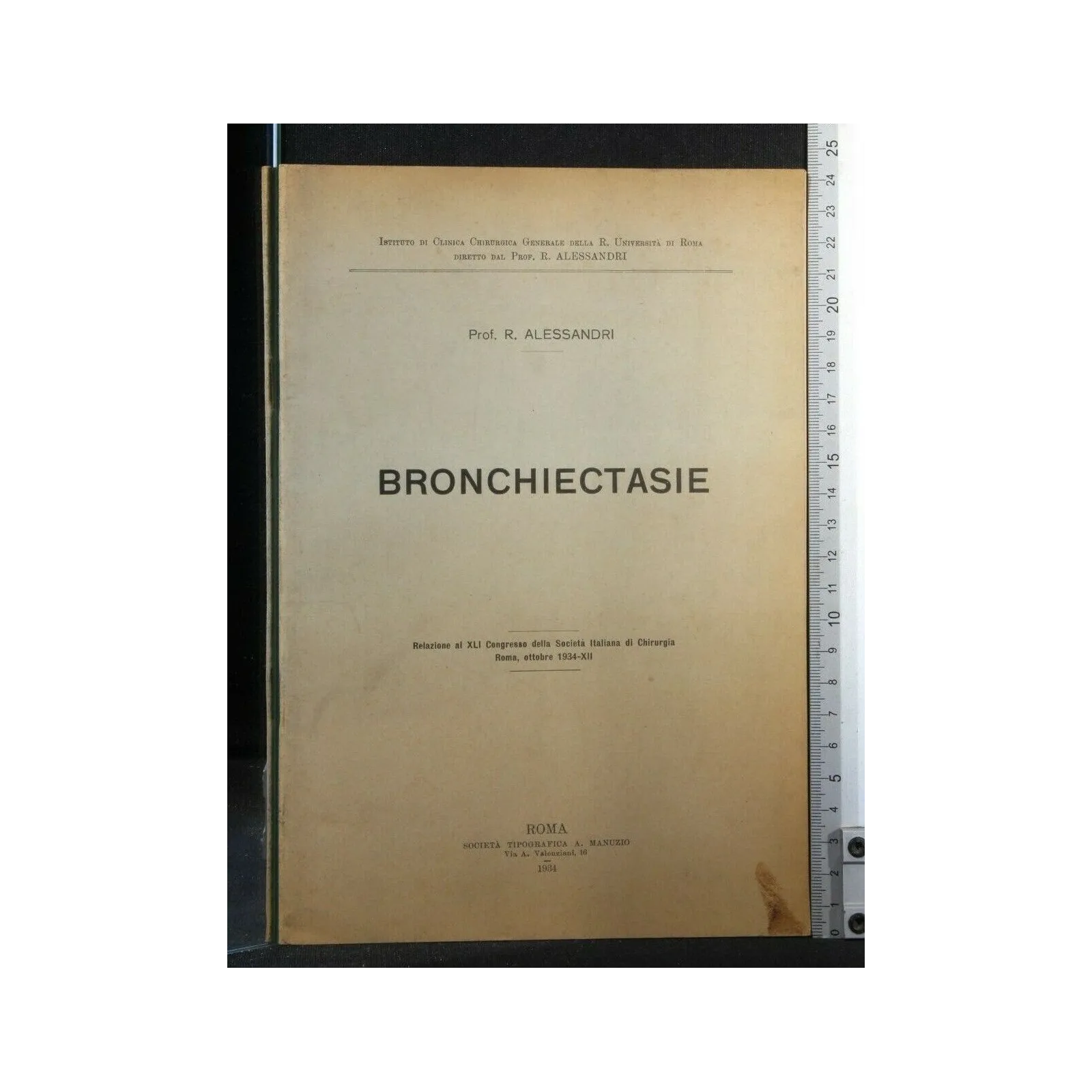 BRONCHIECTASIE