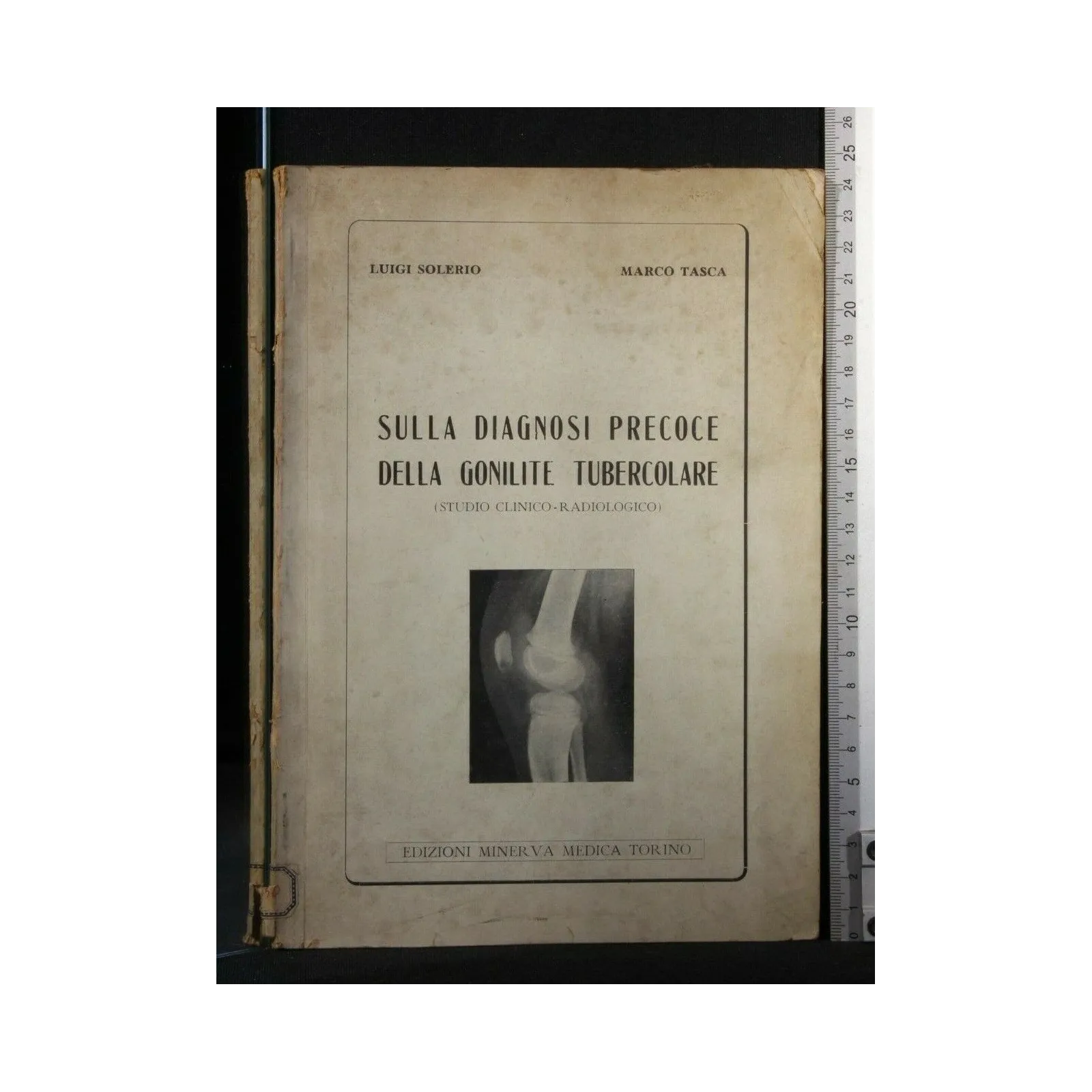SULLA DIAGNOSI PRECOCE DELLA GONILITE TUBERCOLARE