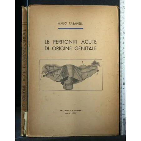 LE PERITONITI ACUTE DI ORIGINE GENITALE