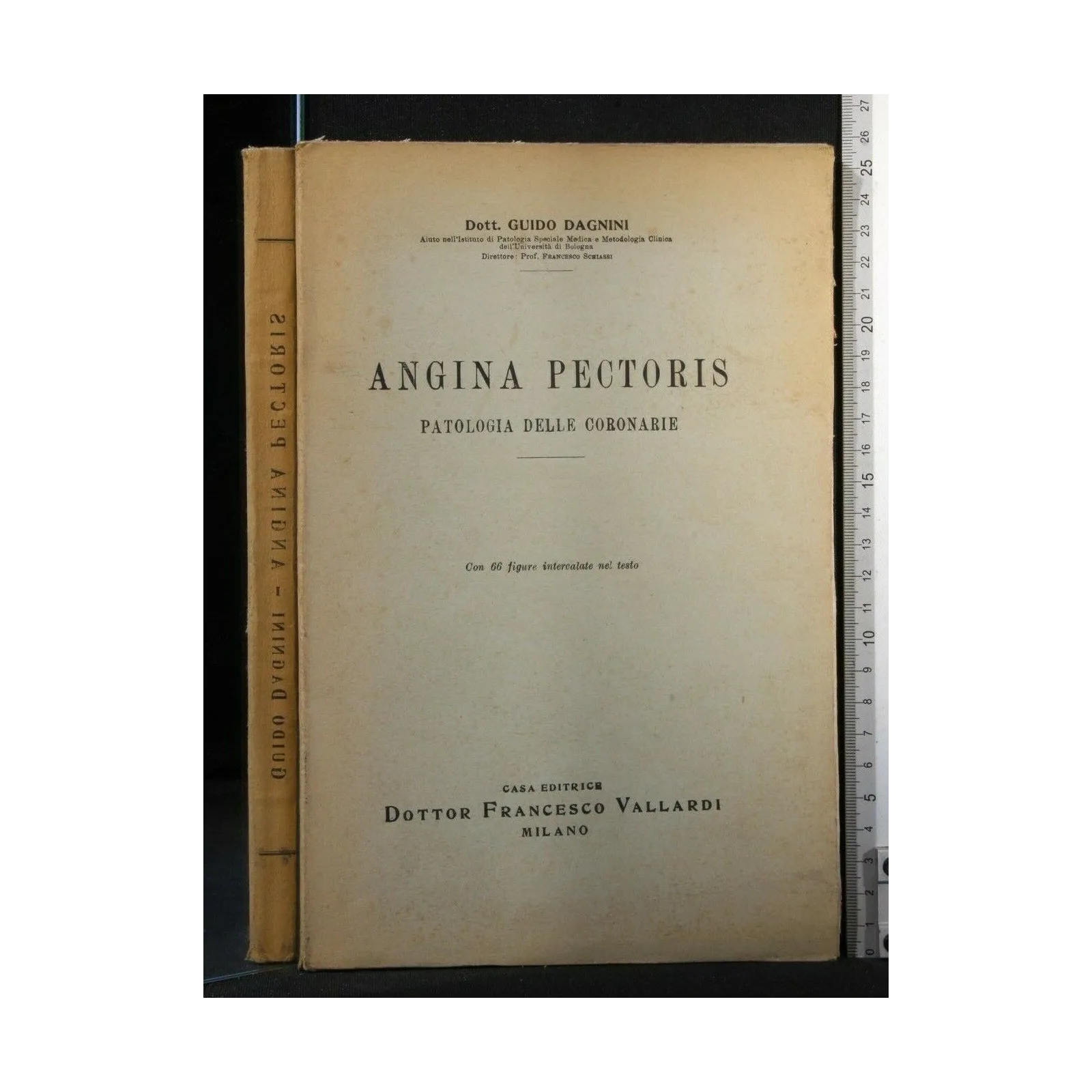 ANGINA PECTORIS. PATOLOGIA DELLE CORONARIE. GUIDO DAGNINI.