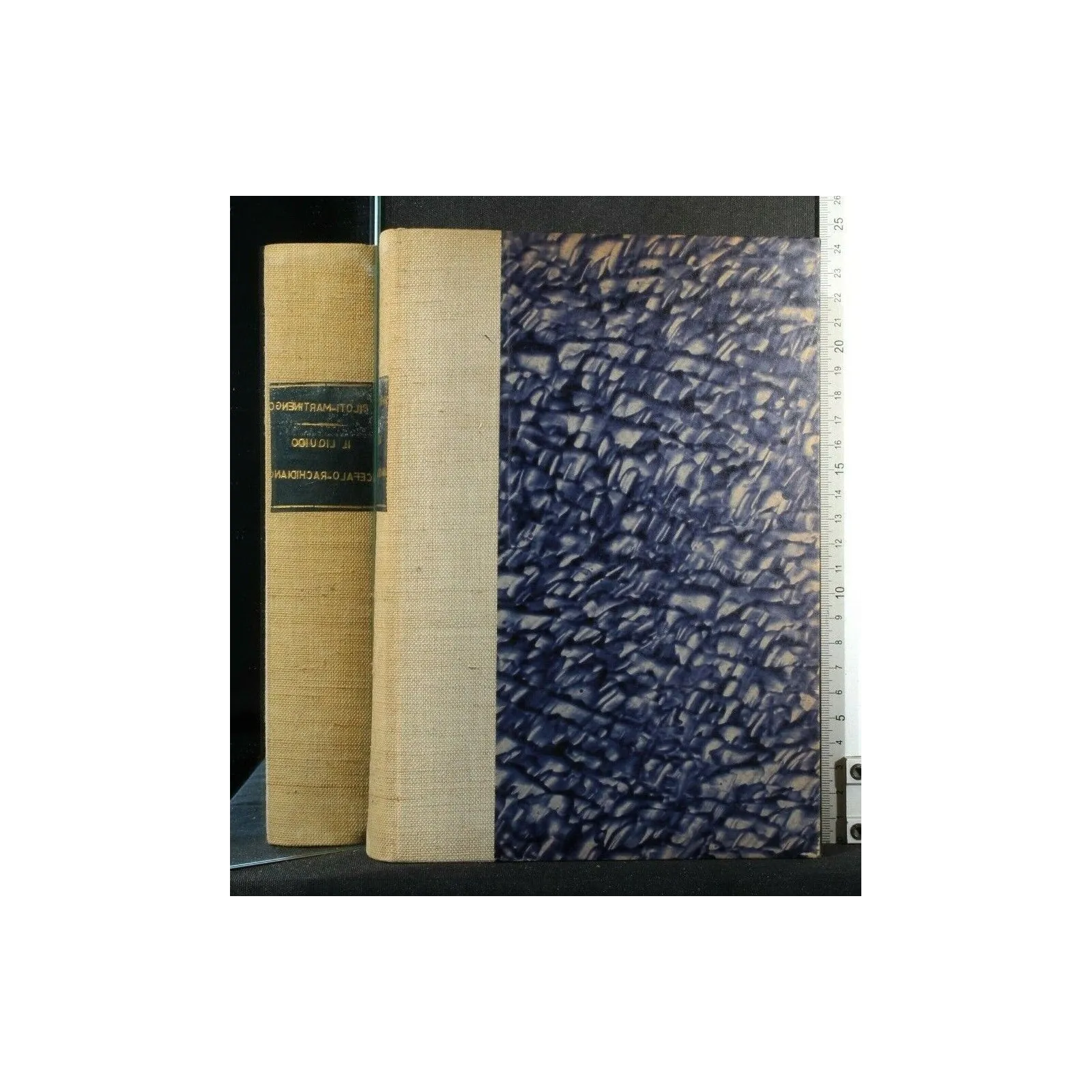 IL LIQUIDO CEFALO-RACHIDIANO NELLA DIAGNOSTICA CLINICA