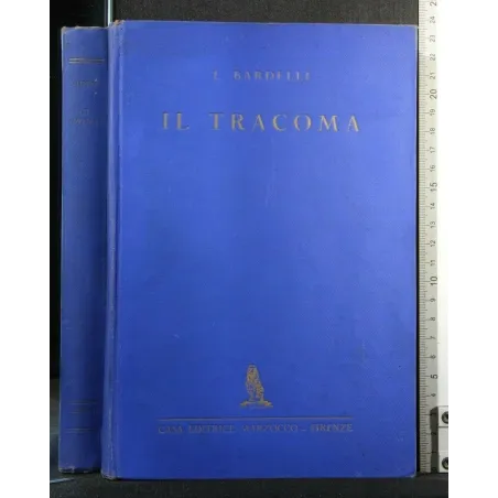IL TRACOMA PRESENZA DI OCCHIALI