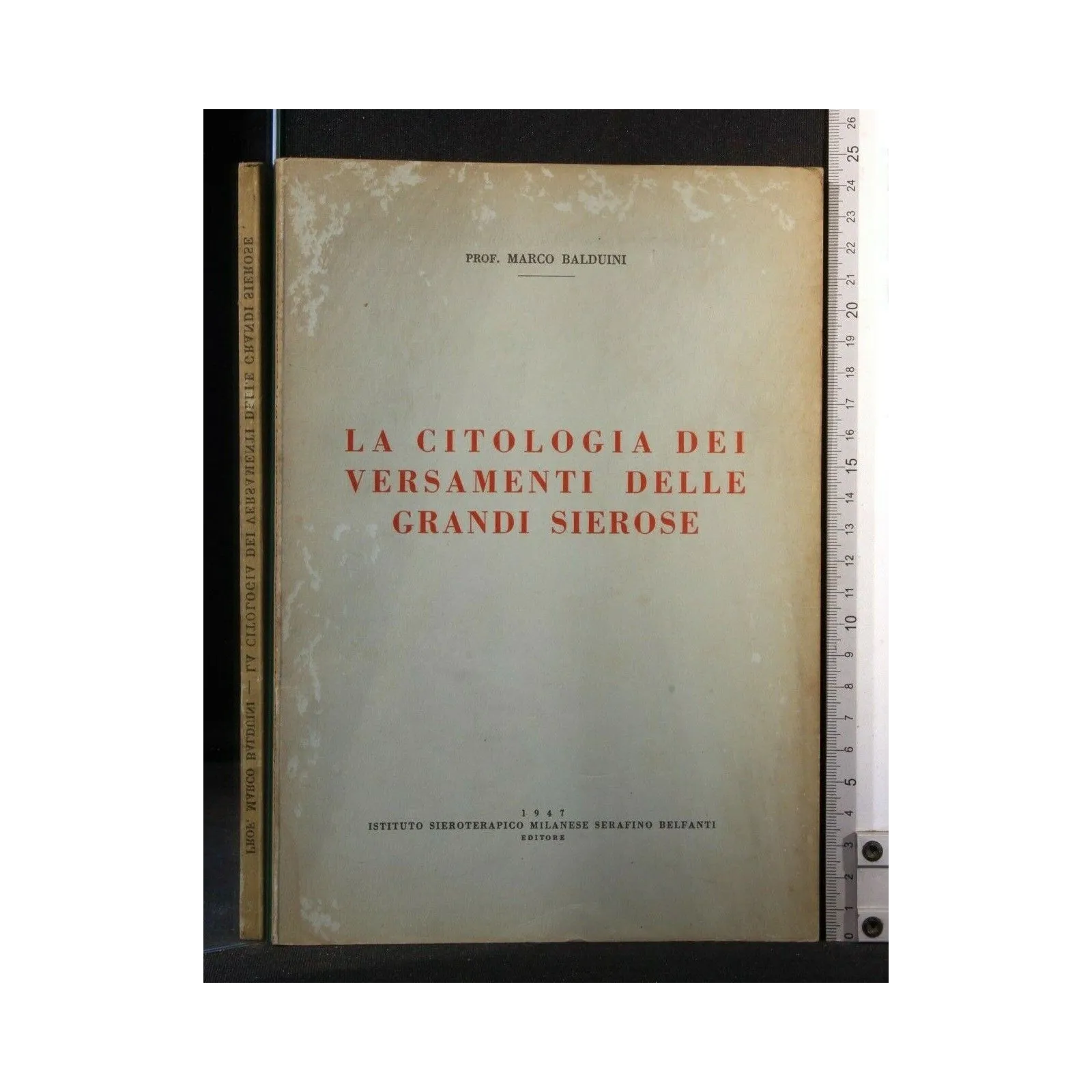 LA CITOLOGIA DEI VERSAMENTI DELLE GRANDI SIEROSE. MARCO