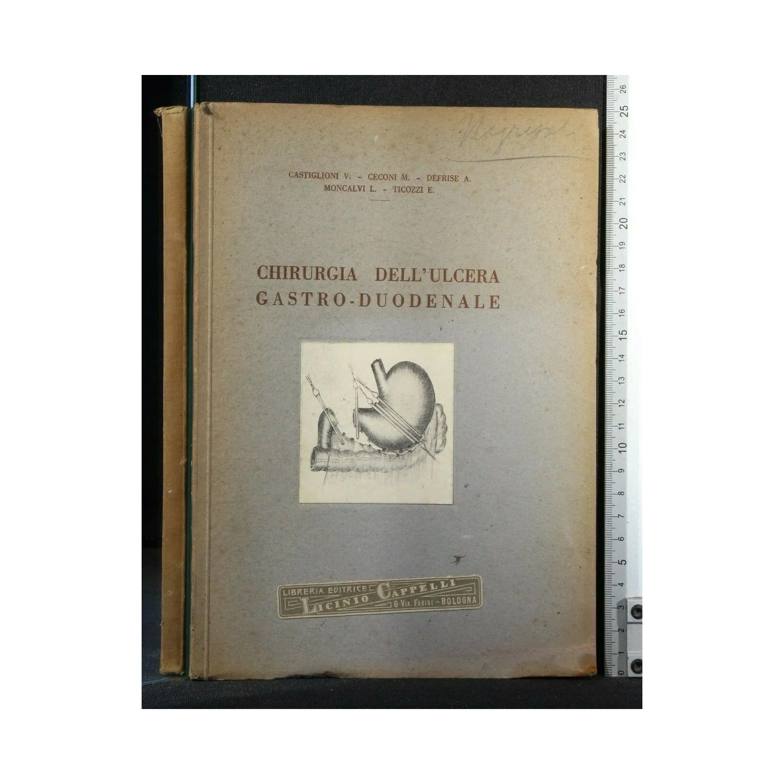 CHIRURGIA DELL'ULCERA GASTRO-DUODENALE