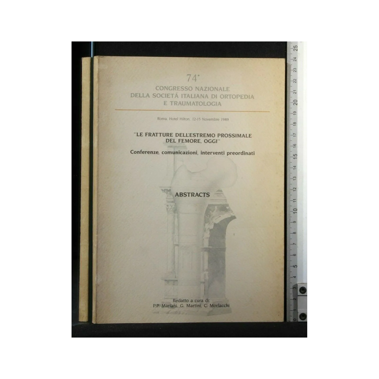 LE FRATTURE DELL'ESTREMO PROSSIMALE DEL FEMORE, OGGI'' 74°