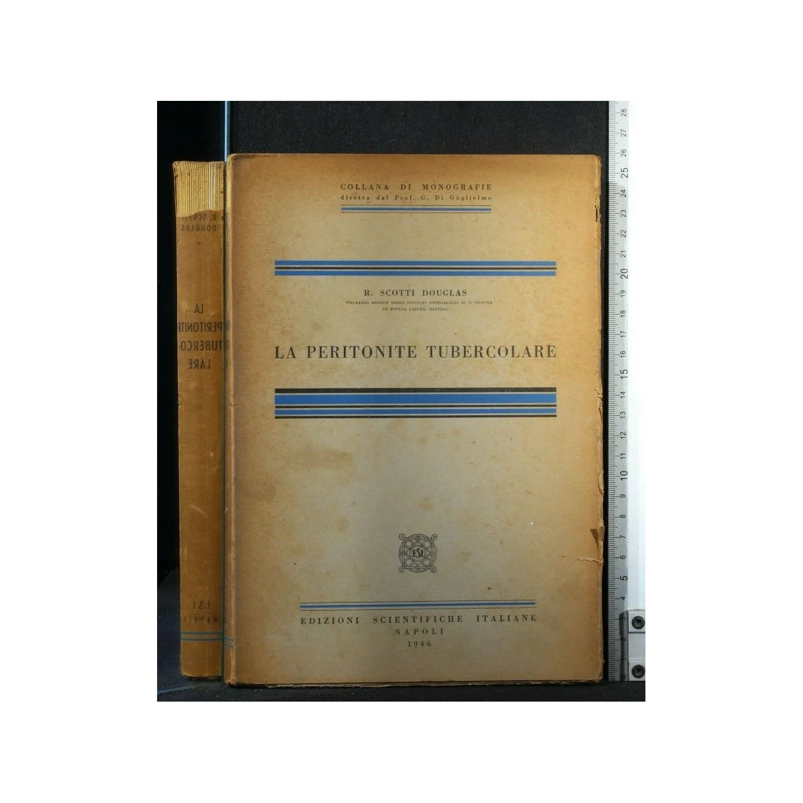 LA PERITONITE TUBERCOLARE