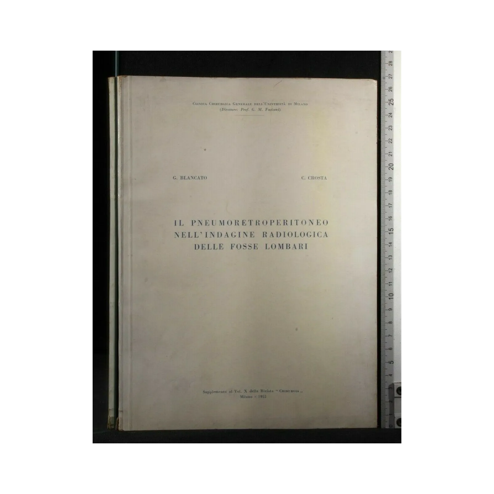 IL PNEUMORETROPERITONEO NELL'INDAGINE RADIOLOGICA DELLE FOSSE