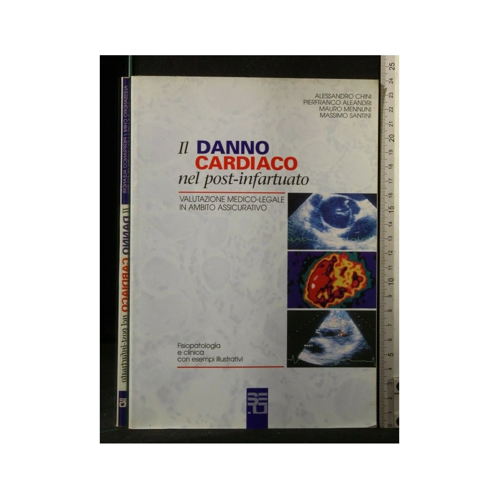 IL DANNO CARDIACO NEL POST-INFARTUATO