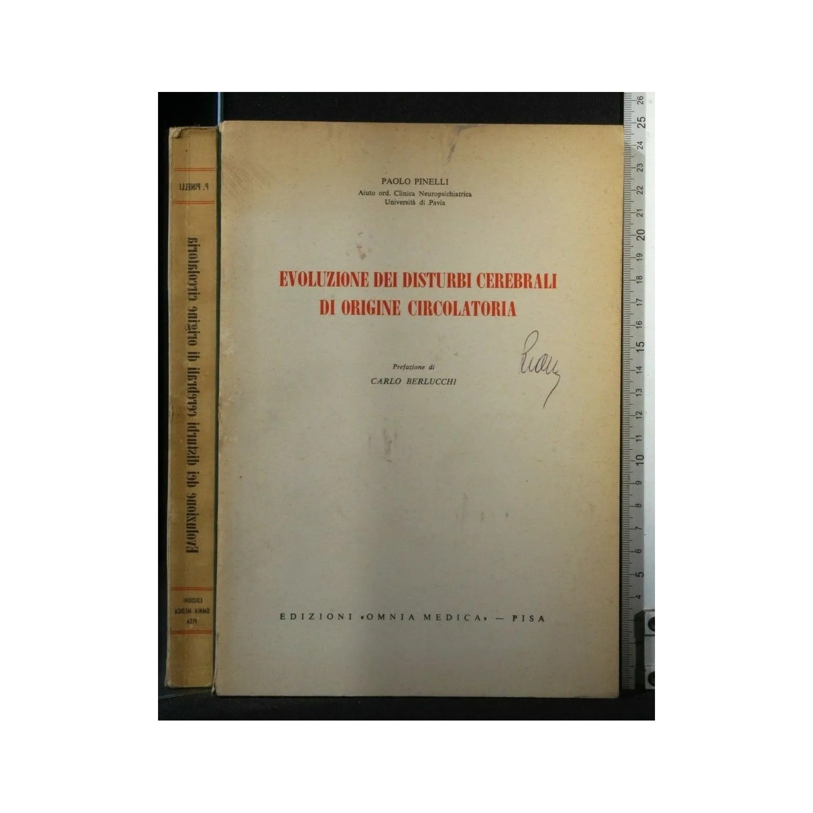 EVOLUZIONE DEI DISTURBI CEREBRALI DI ORIGINE CIRCOLATORIA.