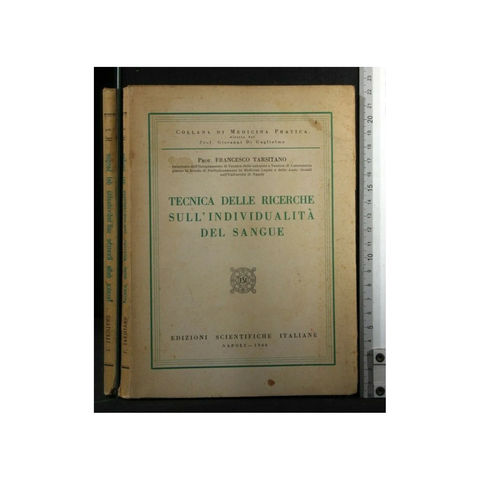 TECNICA DELLE RICERCHE SULL'INDIVIDUALITA' DEL SANGUE