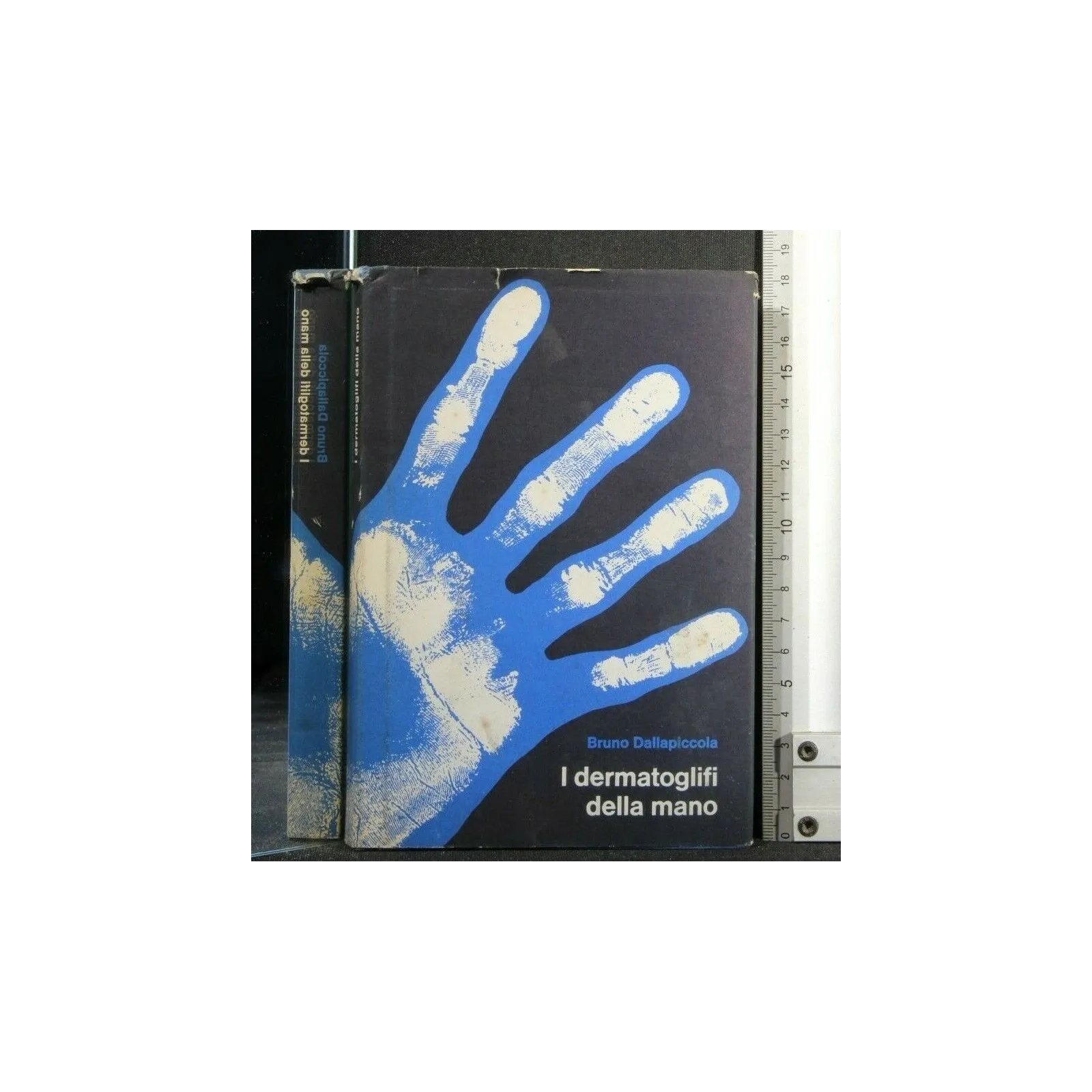 I DERMATOGLIFI DELLA MANO