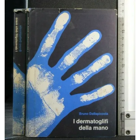 I DERMATOGLIFI DELLA MANO