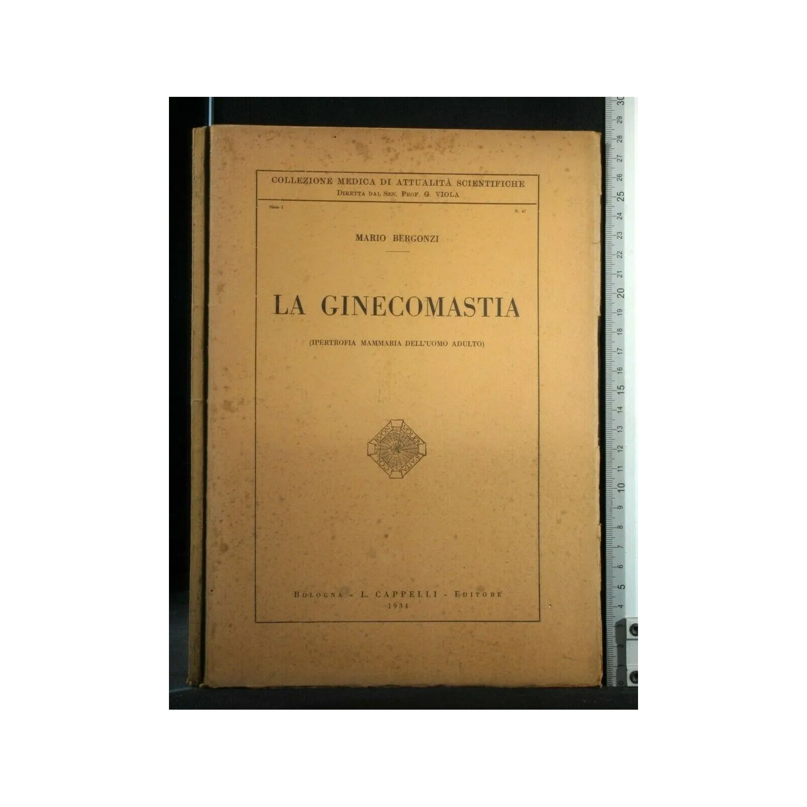 LA GINECOMASTIA