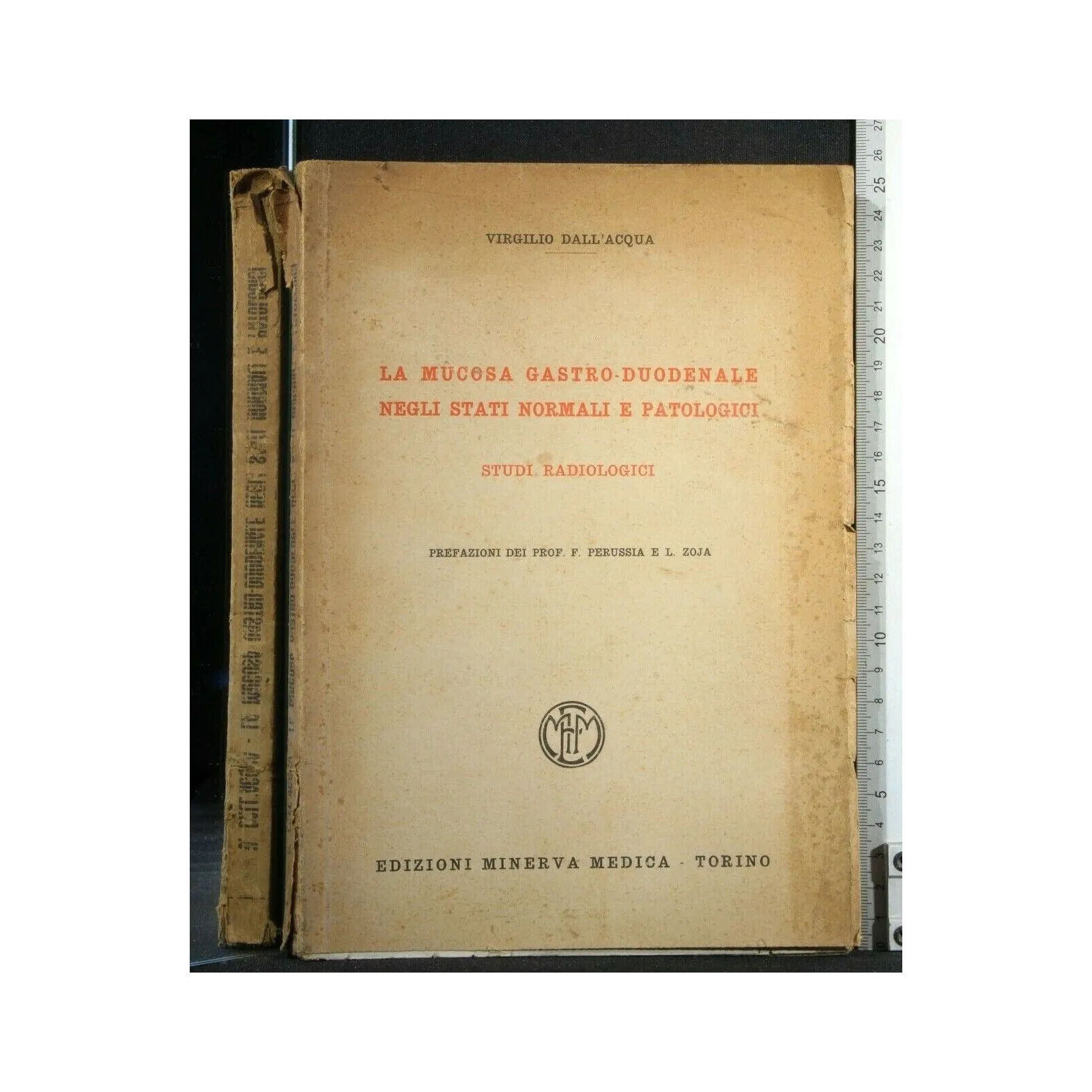LA MUCOSA GASTRO-DUODENALE NEGLI STATI NORMALI E PATOLOGICI