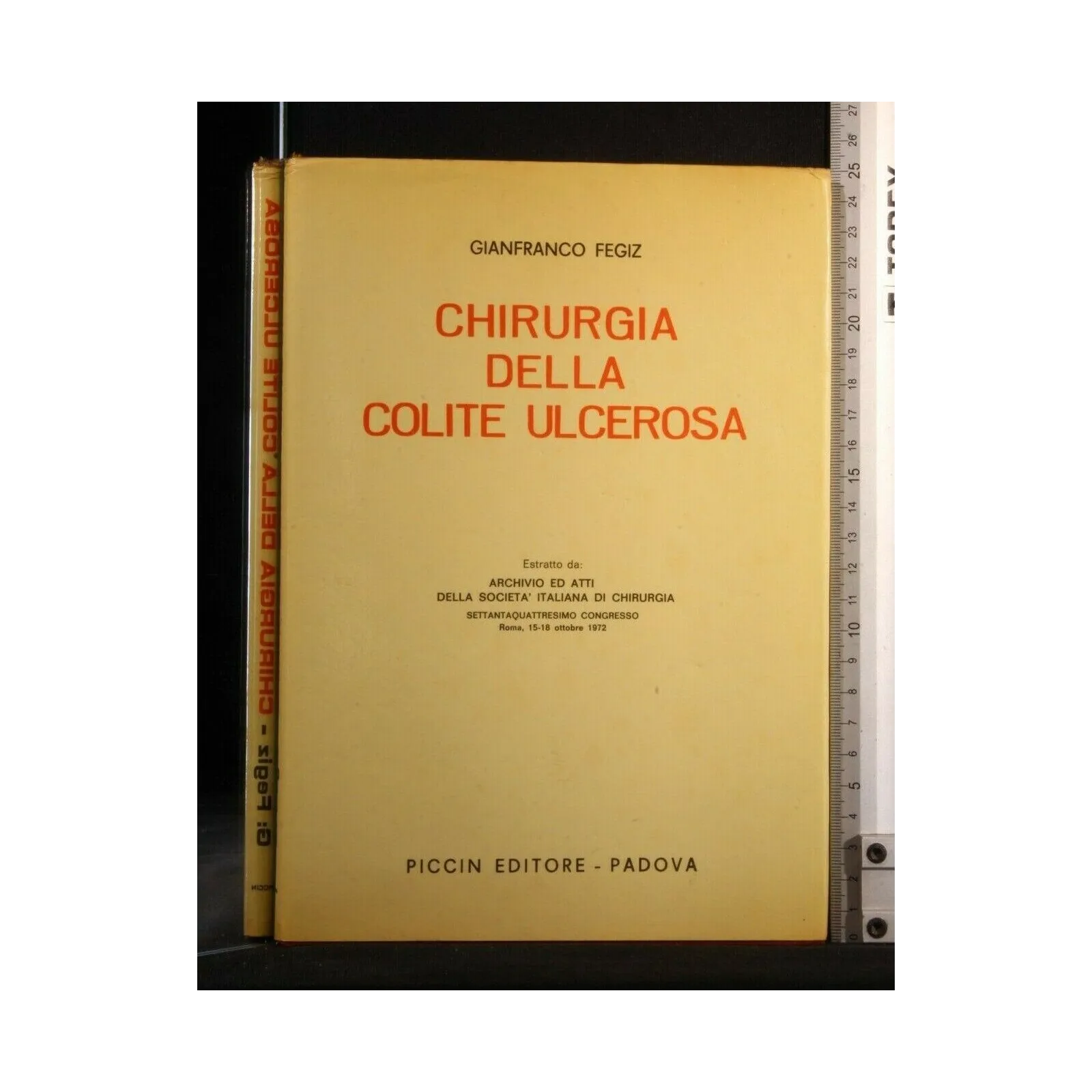CHIRURGIA DELLA COLITE ULCEROSA VOLUME 1