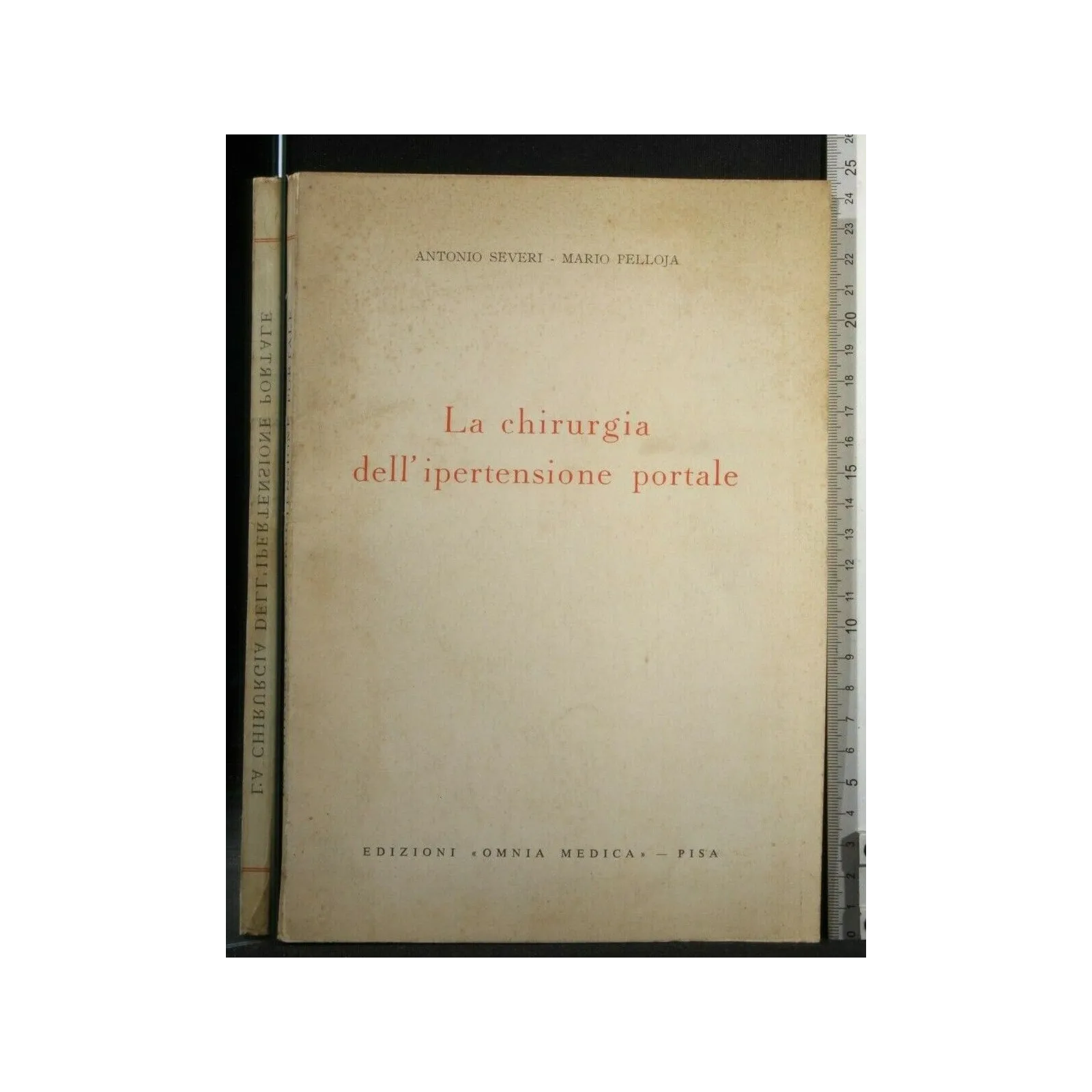 LA CHIRURGIA DELL'IPERTENSIONE PORTALE