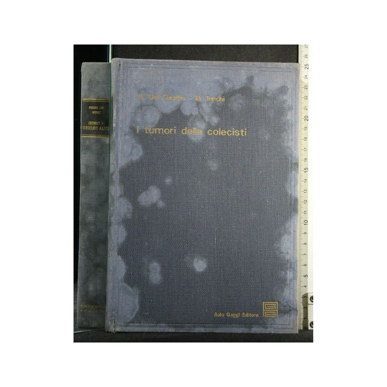 I TUMORI DELLA COLECISTI