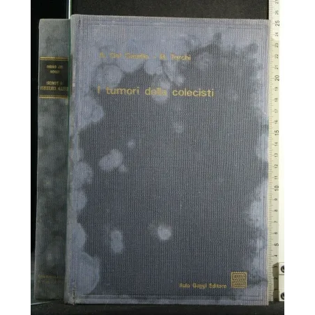 I TUMORI DELLA COLECISTI