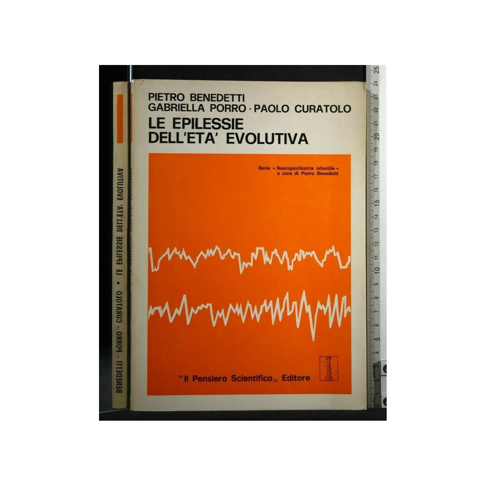 LE EPILESSIE DELL'ETA' EVOLUTIVA