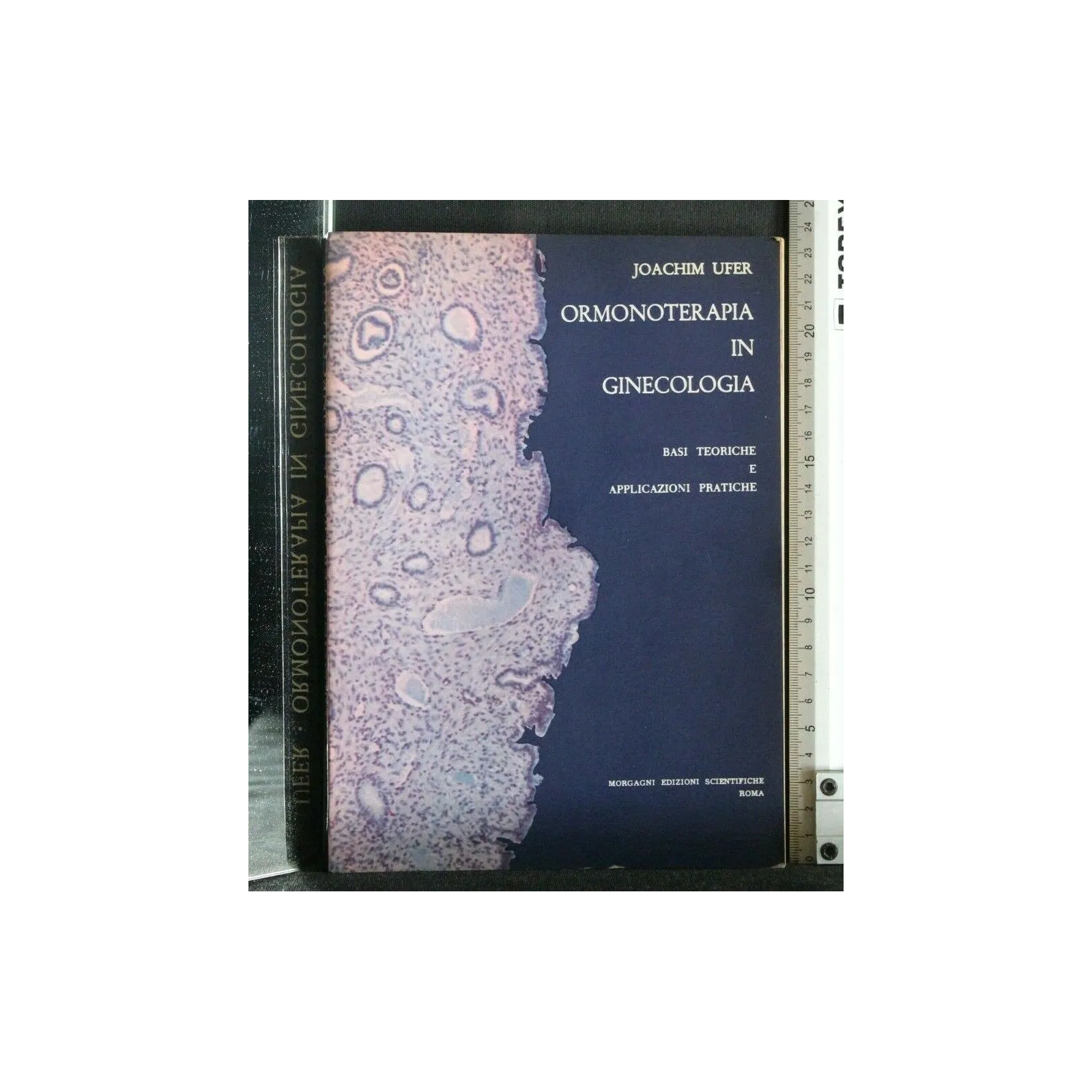 ORMONOTERAPIA IN GINECOLOGIA