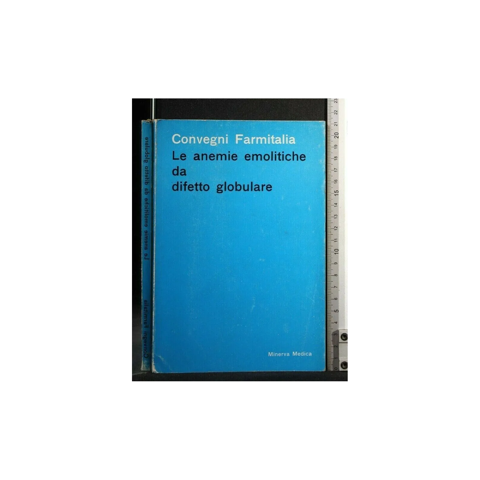 LE ANEMIE EMOLITICHE DA DIFETTO GLOBULARE