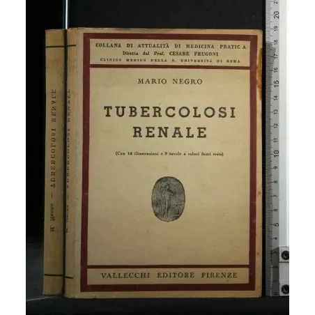 TUBERCOLOSI RENALE