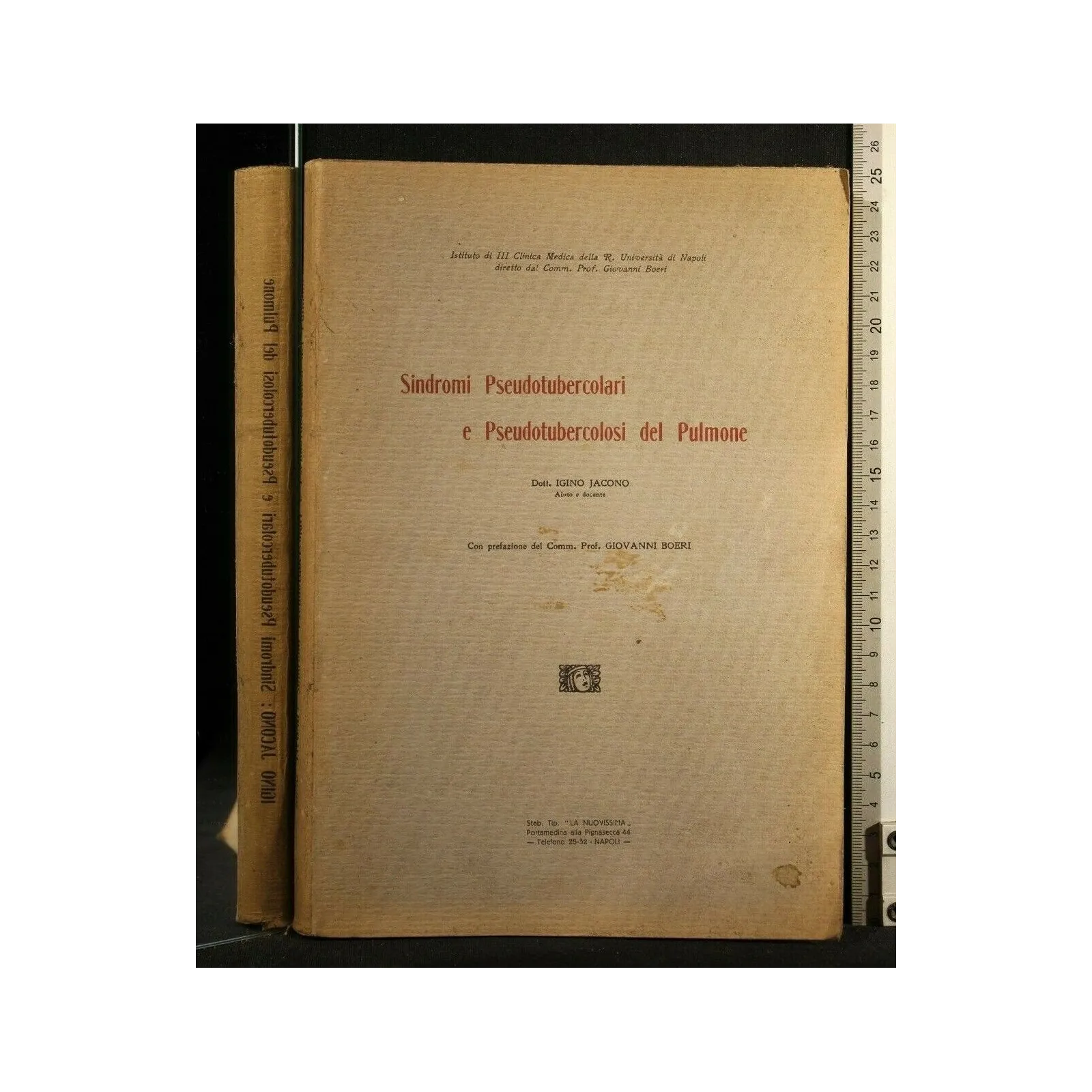 SINDROMI PSEUDOTUBERCOLARI E PSEUDOTUBERCOLOSI DEL PULMONE