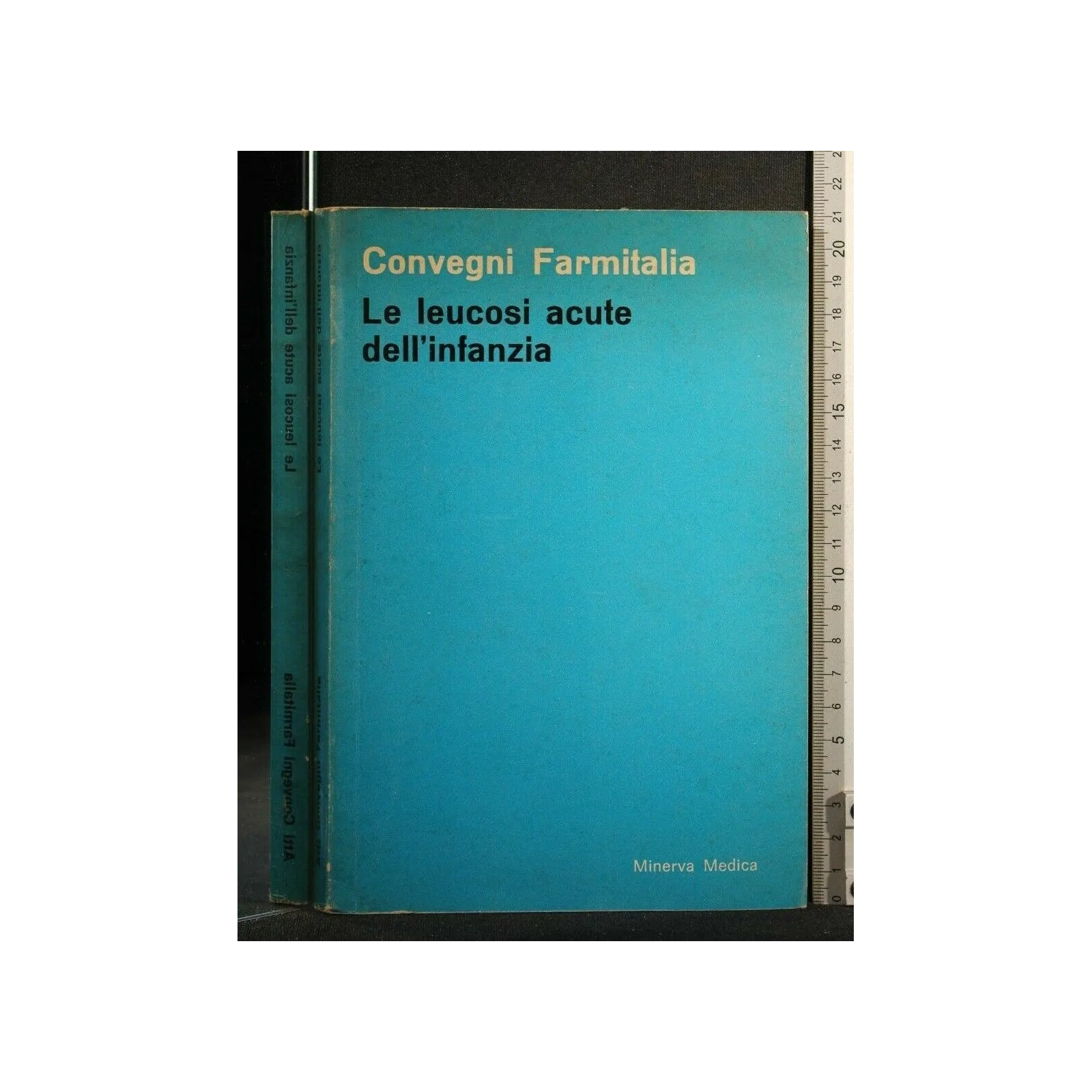 LE LEUCOSI ACUTE DELL'INFANZIA