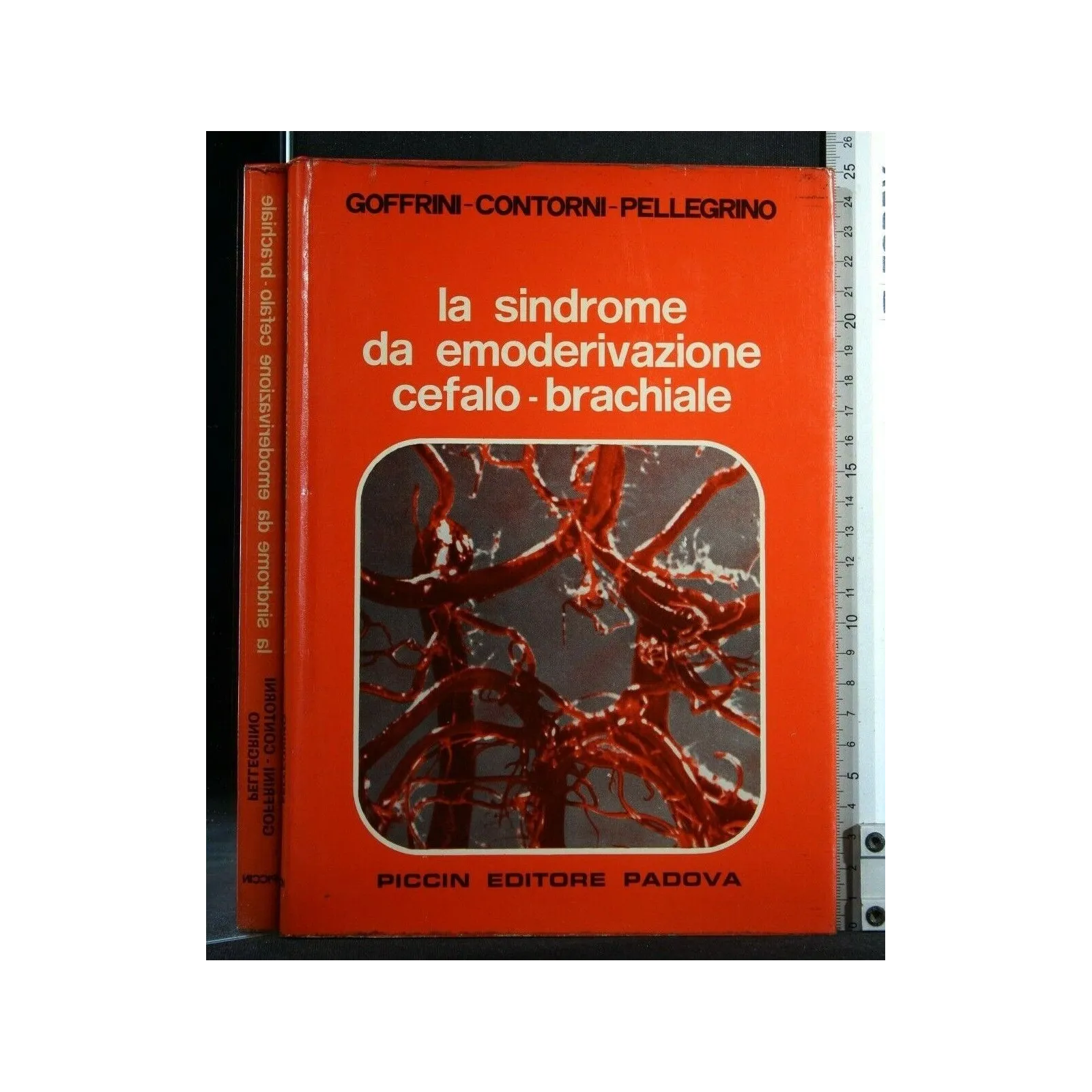 LA SINDROME DA EMODERIVAZIONE CEFALO-BRACHIALE