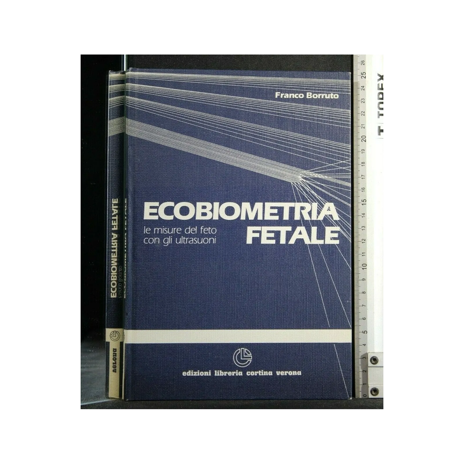 ECOBIOMETRIA FETALE LE MISURE DEL FETO CON GLI ULTRASUONI
