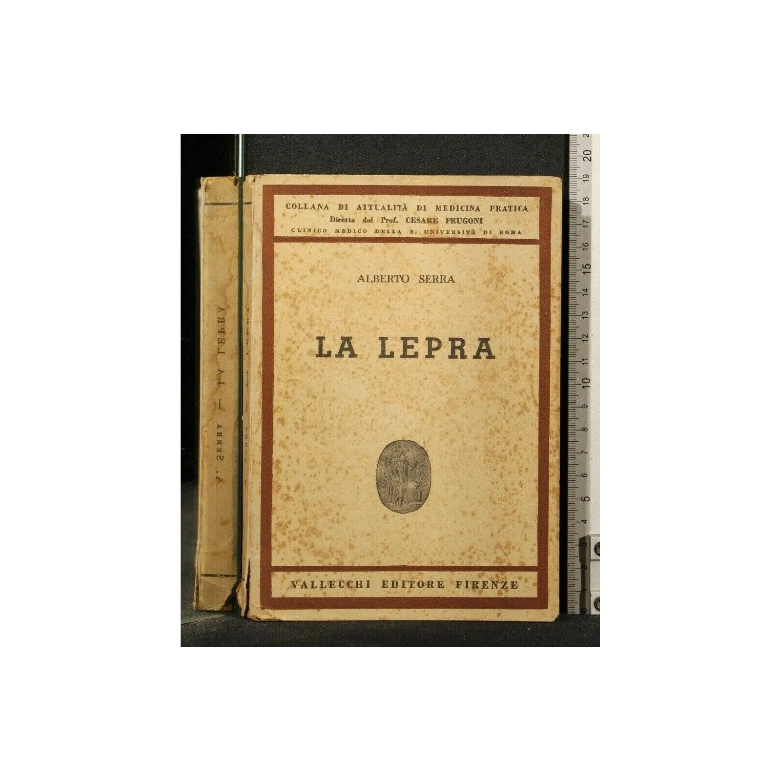 LA LEPRA