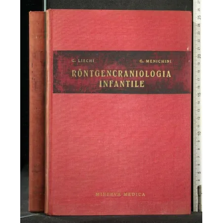 RONTGENCRANIOLOGIA INFANTILE