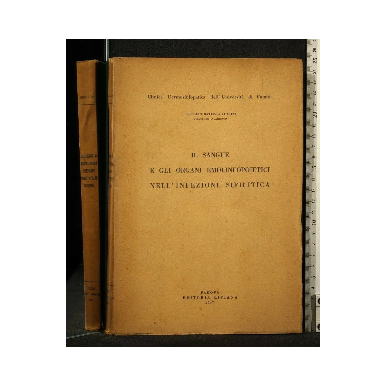 IL SANGUE E GLI ORGANI EMOLINFOPOIETICI NELL'INFEZIONE
