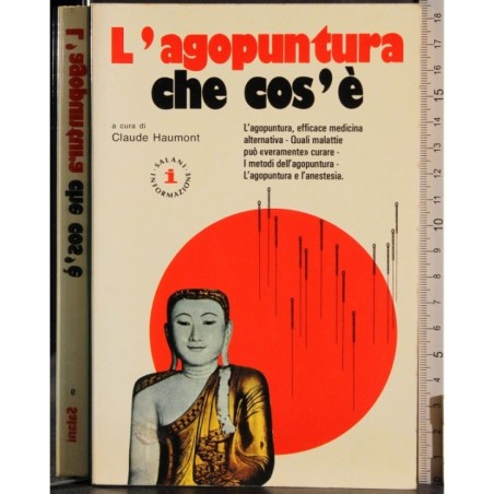 L'agopuntura che cos'è
