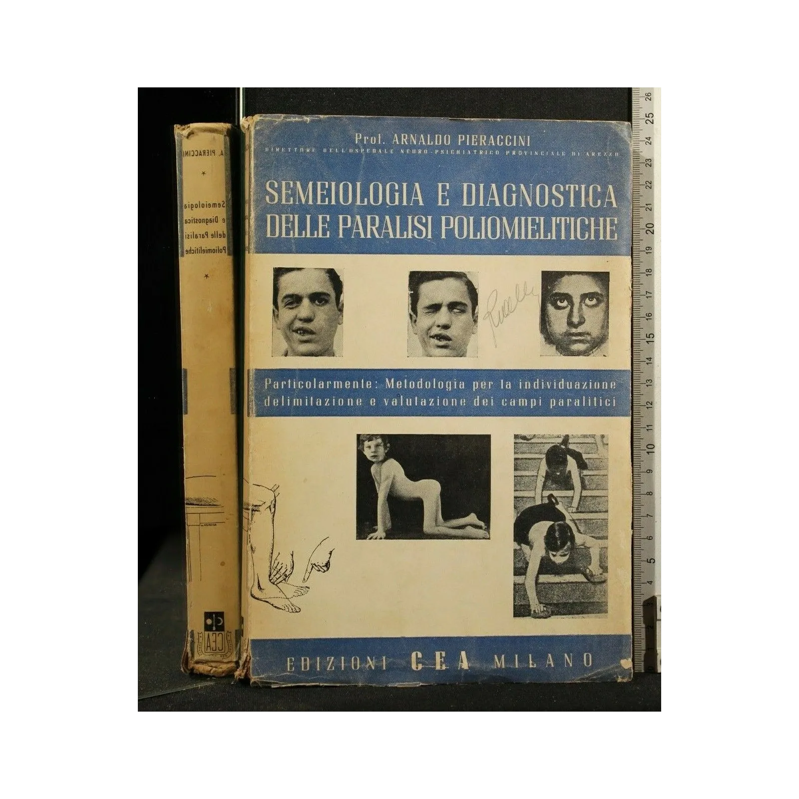 SEMEIOLOGIA E DIAGNOSYICA DELLE PARALISI POLIOMIELITICHE