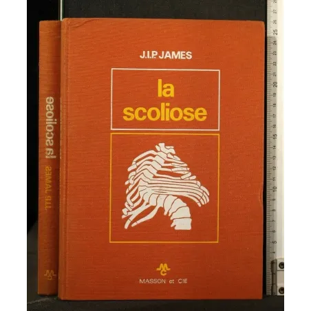 LA SCOLIOSE
