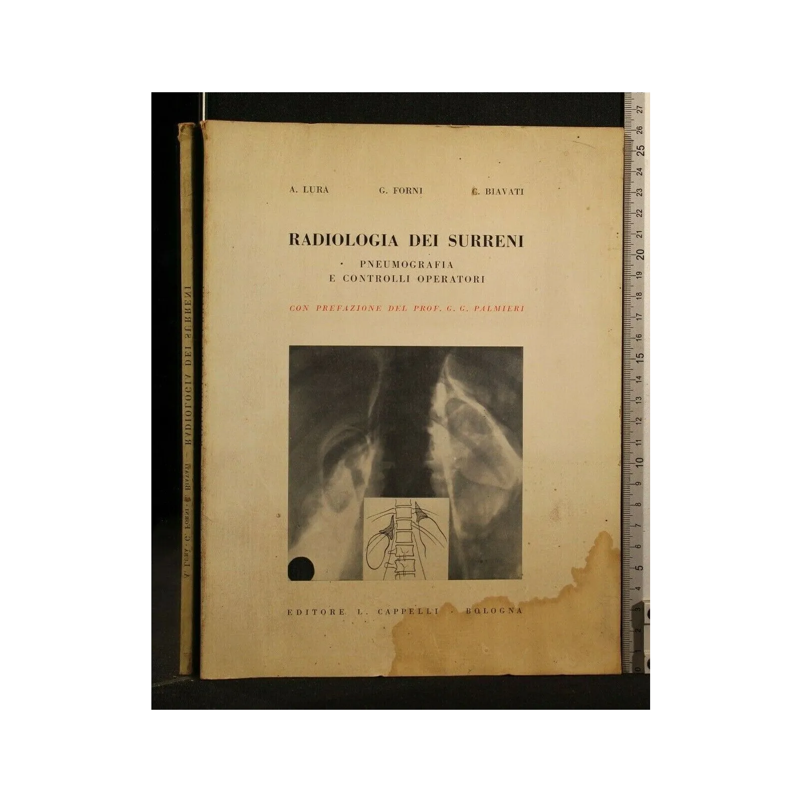 RADIOLOGIA DEI SURRENI