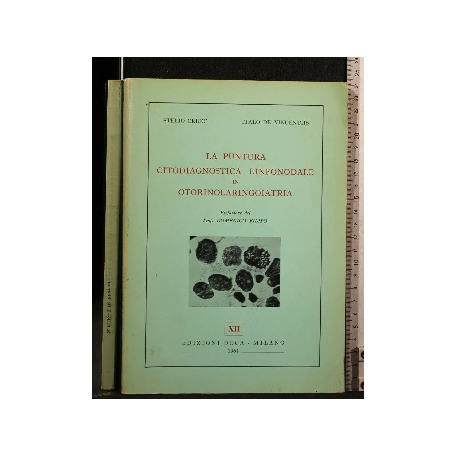 LA PUNTURA CITODIAGNOSTICA LINFONODALE IN OTORINOLARINGOIATRIA