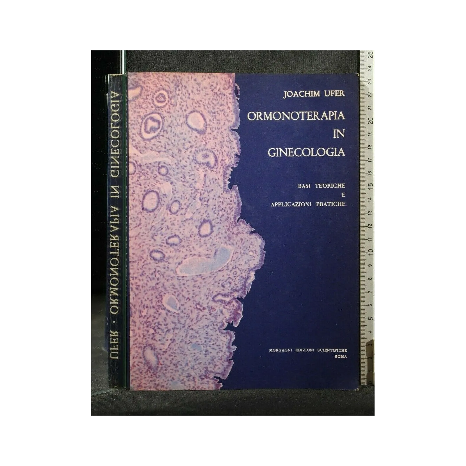 ORMONOTERAPIA IN GINECOLOGIA
