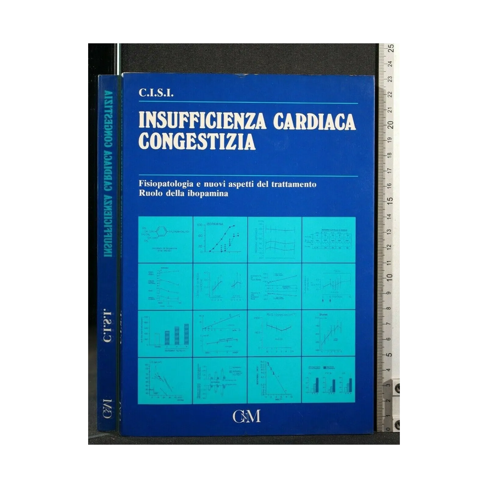 INSUFFICIENZA CARDIACA CONGENITA