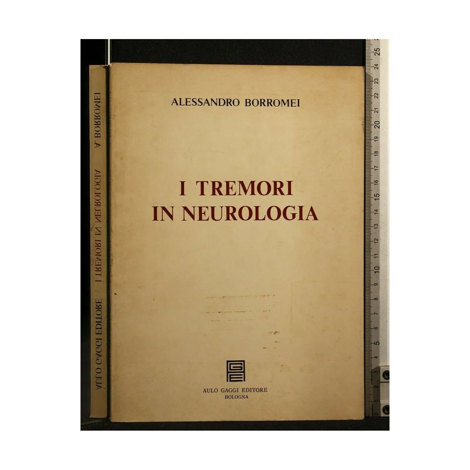 I TREMORI IN NEUROLOGIA