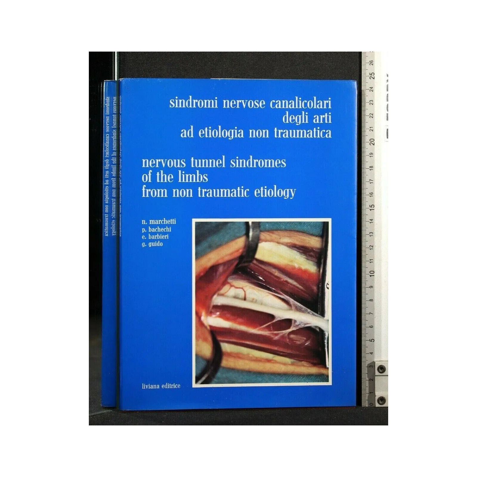 SINDROMI NERVOSE CANALICOLARI DEGLI ARTI AD ETIOLOGIA NON