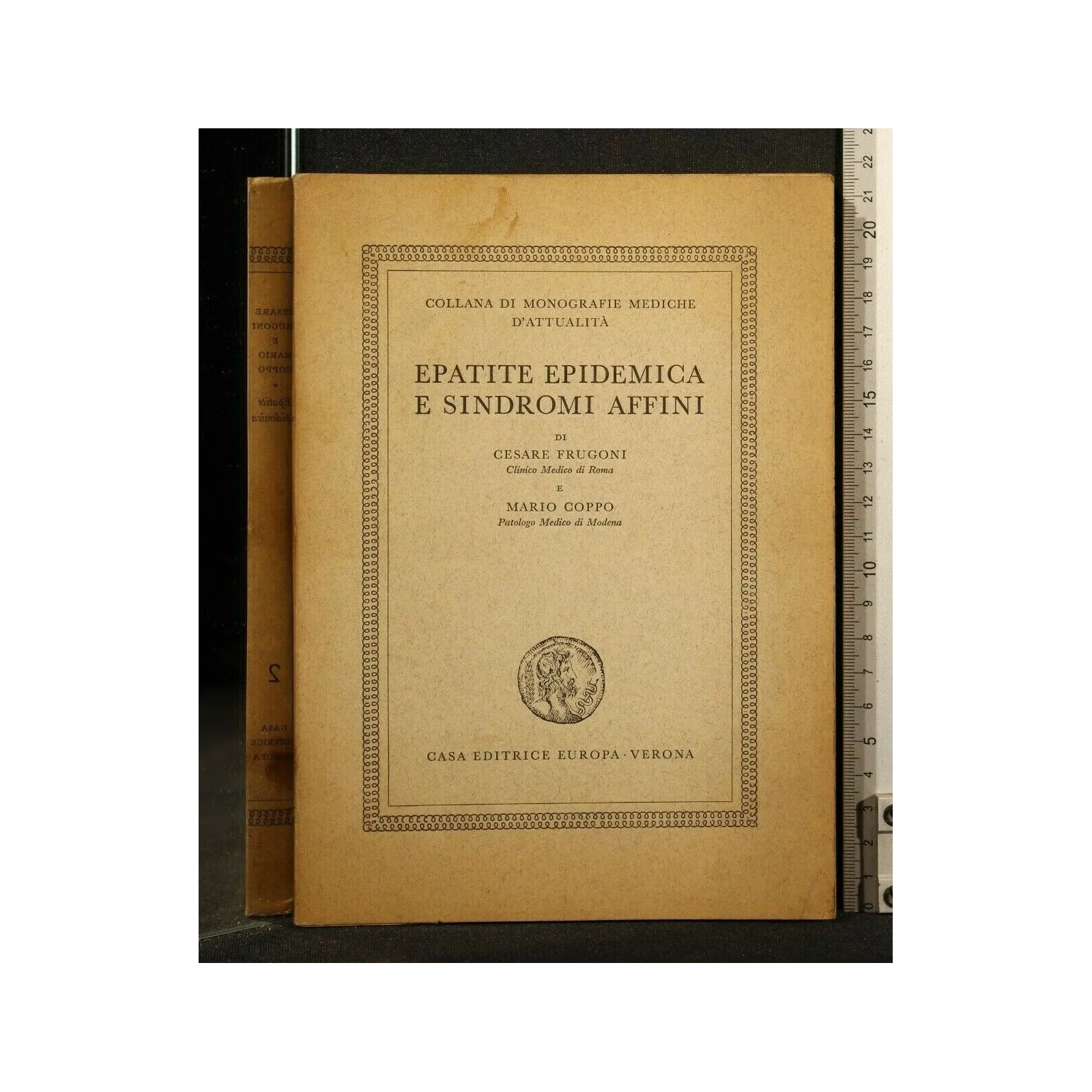 EPATITE EPIDEMICA E SINDROMI AFFINI