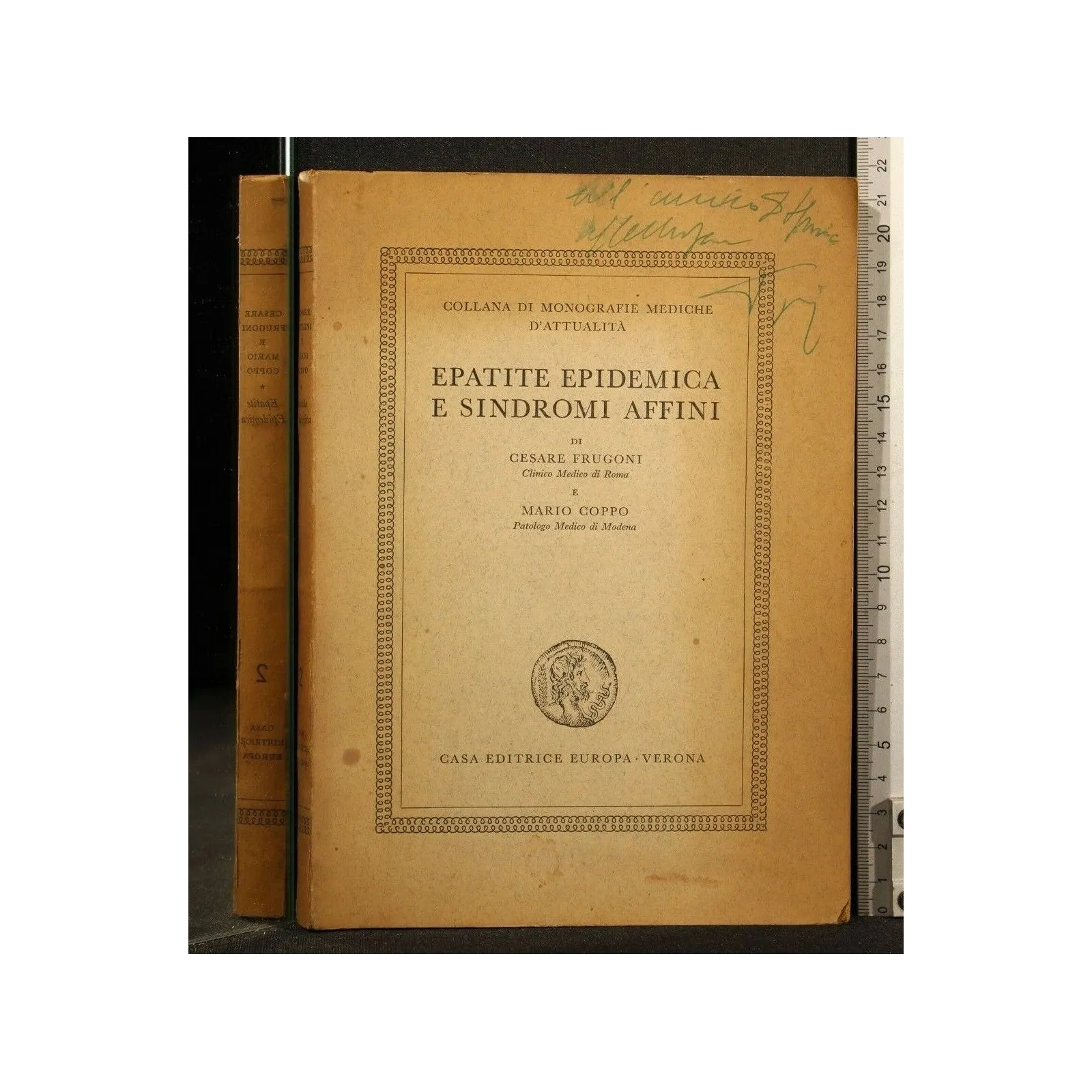 EPATITE EPIDEMICA E SINDROMI AFFINI