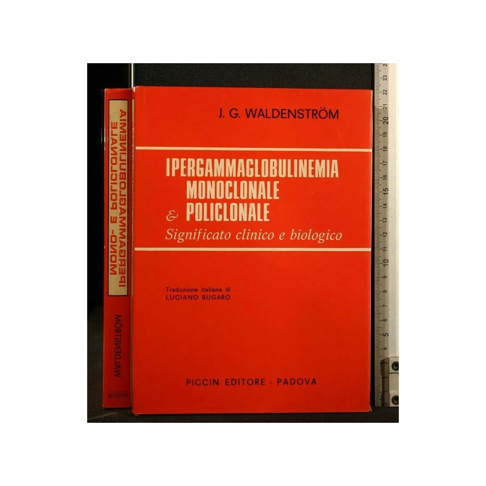 IPERGAMMAGLOBULINEMIA MONOCLONALE E POLICLONALE