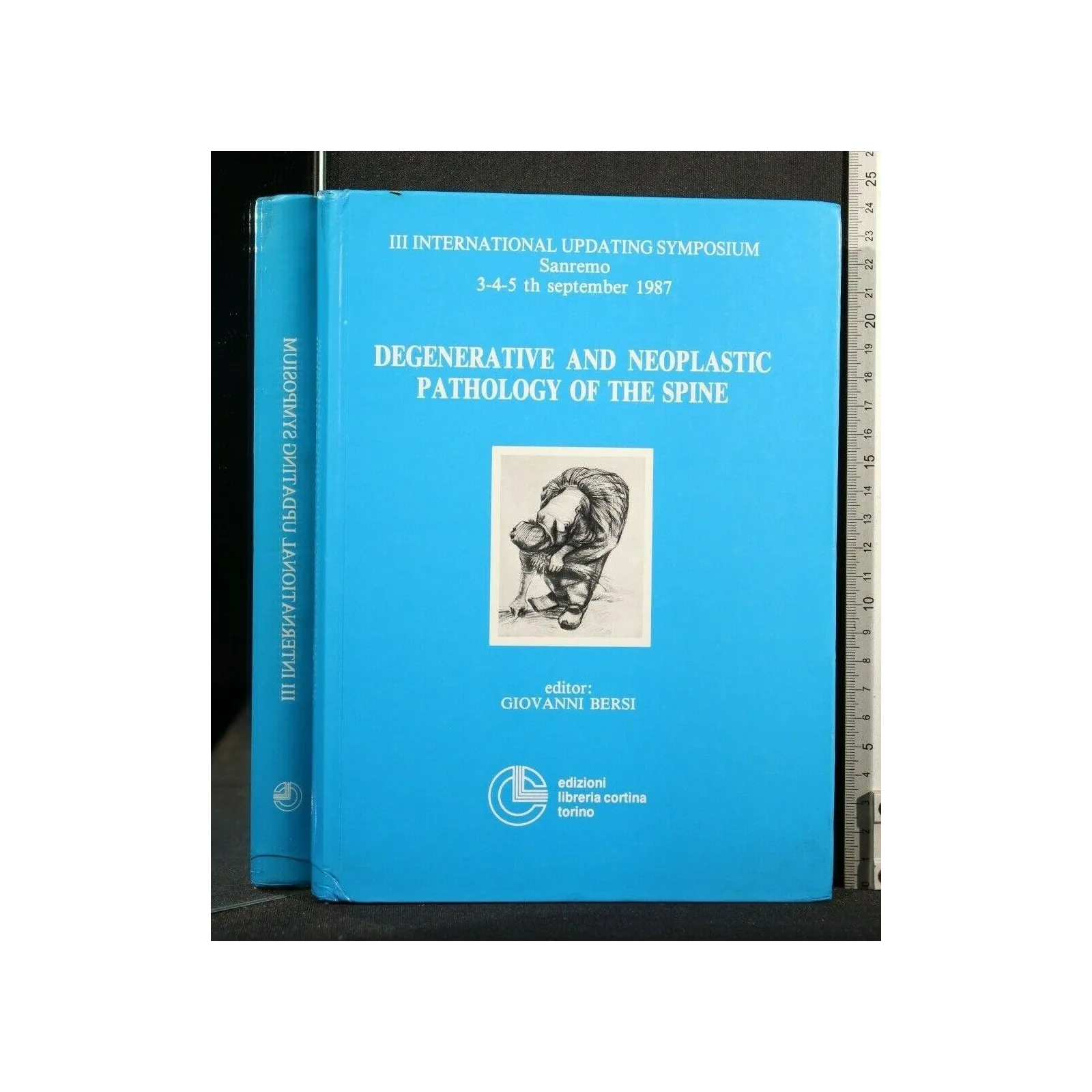 DEGENERATIVE AND NEOPLASTIC PATHOLOGY OF THE SPINE