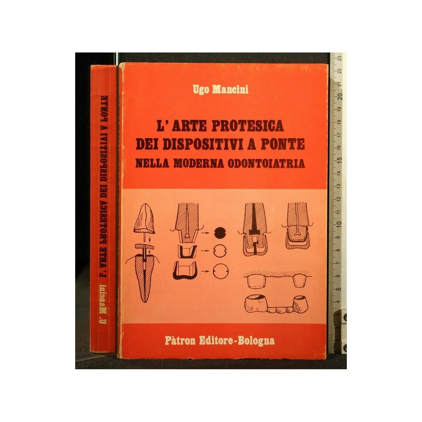 L'ARTE PROTESICA DEI DISPOSITIVI A PONTE NELLA MODERNA