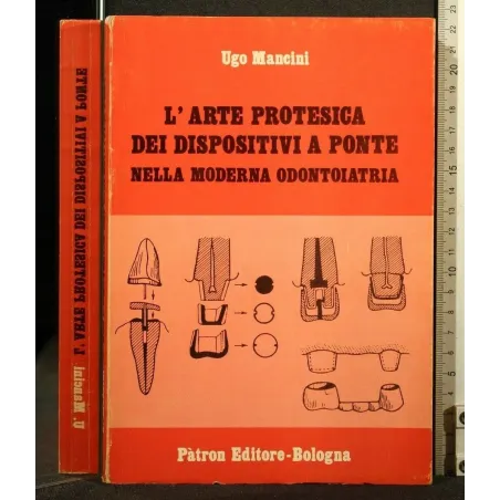 L'ARTE PROTESICA DEI DISPOSITIVI A PONTE NELLA MODERNA